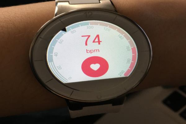 millonesvalor smartw